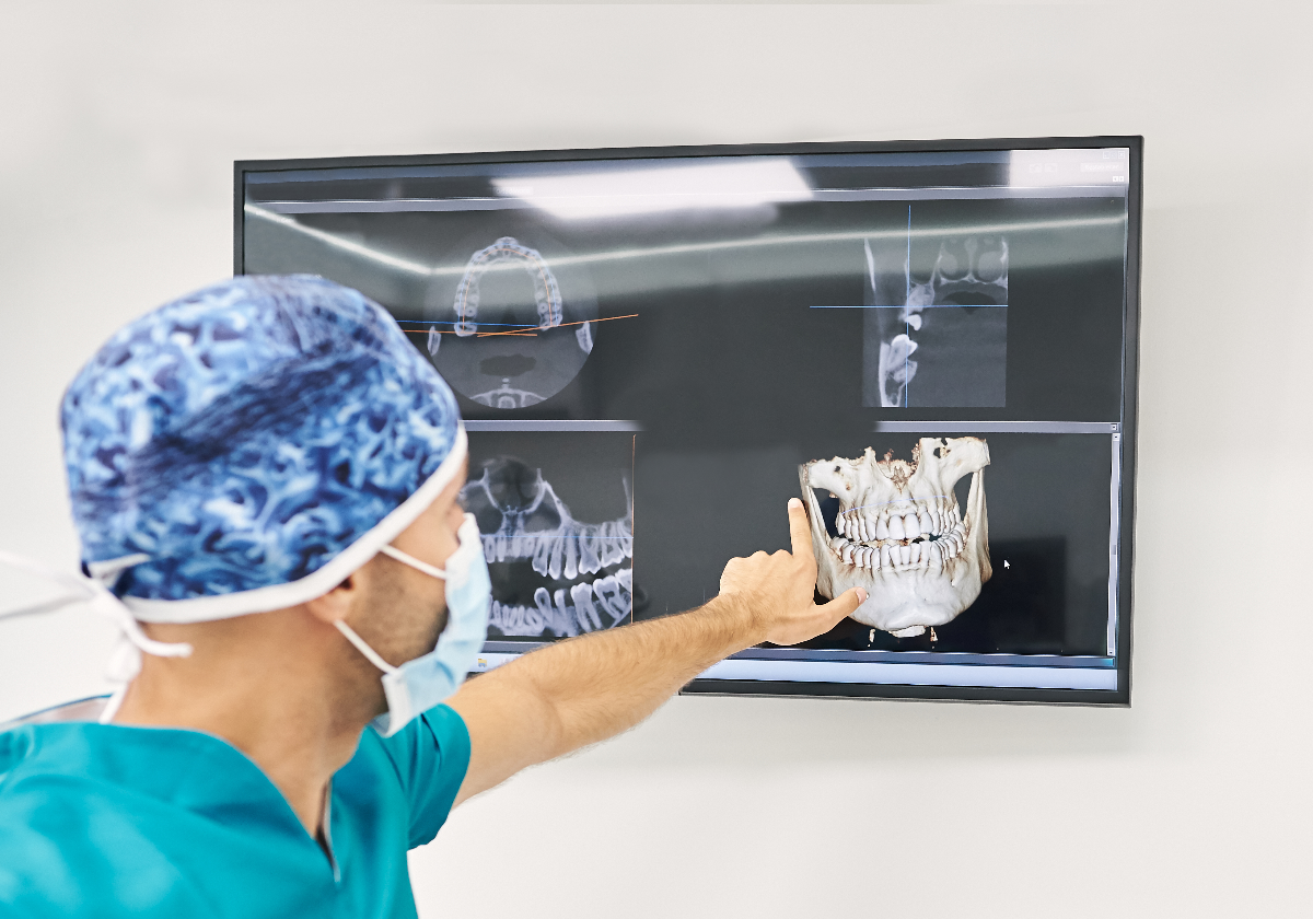 Odontoiatria per lo sport